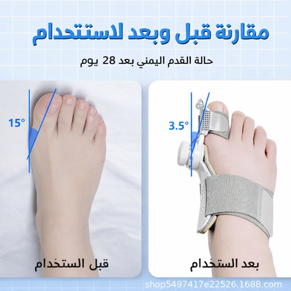 مصحّح إبهام القدم الطبي 🦶